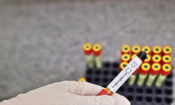 HDT alerta para cuidados essenciais contra a leptospirose no período chuvoso